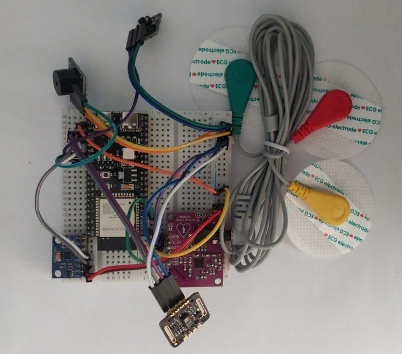 Breadboard prototype with the ECG leads attached